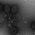 A transmission electron micrographs of prochlorococcus virus