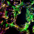 engineered tissue