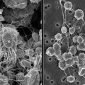 euryarchaeota-methanogen