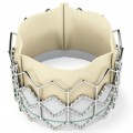 first-transcatheter-aortic-valve-replacement-TAVR