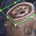 fmri-scan-vegetative-state-patient