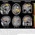 functional-neuroimaging