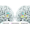 fusiform-gyri