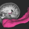 hippocampus is a key brain structure important to learning