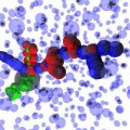 intracellular-crowding-t-cell