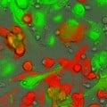 killing of three melanoma cells by a single non-cancer-specific Tcell