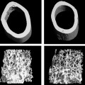 link between a common protein and stem cells provides a deeper understanding of osteoporosis