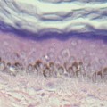 magnification of the four distinct strata of human skin