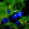 male-cell-female-liver-tissue