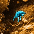 melanoma-protein-search