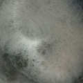 methane consuming microorganisms