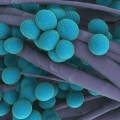 methicillin-resistant-staphylococcus-aureus
