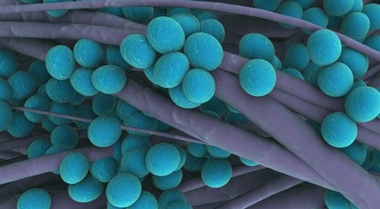 methicillin resistant staphylococcus aureus