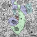 microglia-in-brain