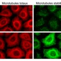 molecule with anti-cancer and anti-metastatic properties
