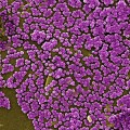 mrsa-electron-microscope-found-cdc