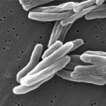 multi-drug-resistant-tuberculosis