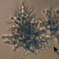 multicellular-yeast
