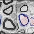 myelination