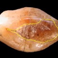 neolithic-dentistry-tooth