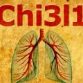 protein Chi3l1 role in regulating the immune response to pneumonia