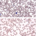 researchers have identified a method to help cancer patients maintain a healthy blood supply