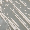 researchers learn how populations collapse from yeast