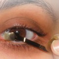 retinal-prosthetic