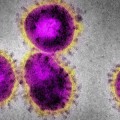 sars-coronavirus