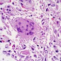 sars-coronavirus-cdc