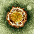 sars-coronavirus-virion