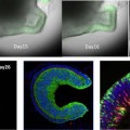 scientists grow human-eye precursor from stem cells