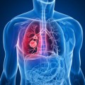 significant reductions of tumor size after taking a new antibody drug