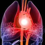 stem-cell-therapy-heart-attack