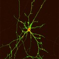 stem cells could help restore the muscle coordination deficits