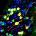 stem-cells-differentiated-auditory-neurons