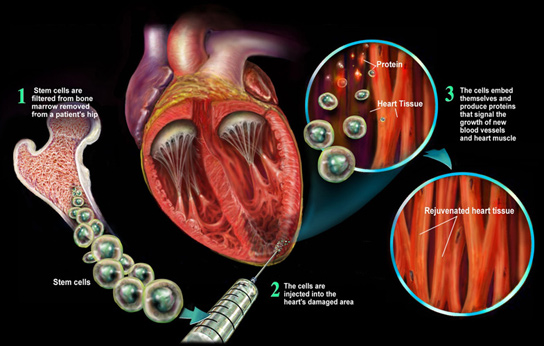 stem-cells-heart