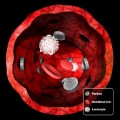 the best shape for cancer-fighting nanoparticles