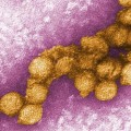 West Nile Virus Might Be Linked to Kidney Problems west-nile-virus