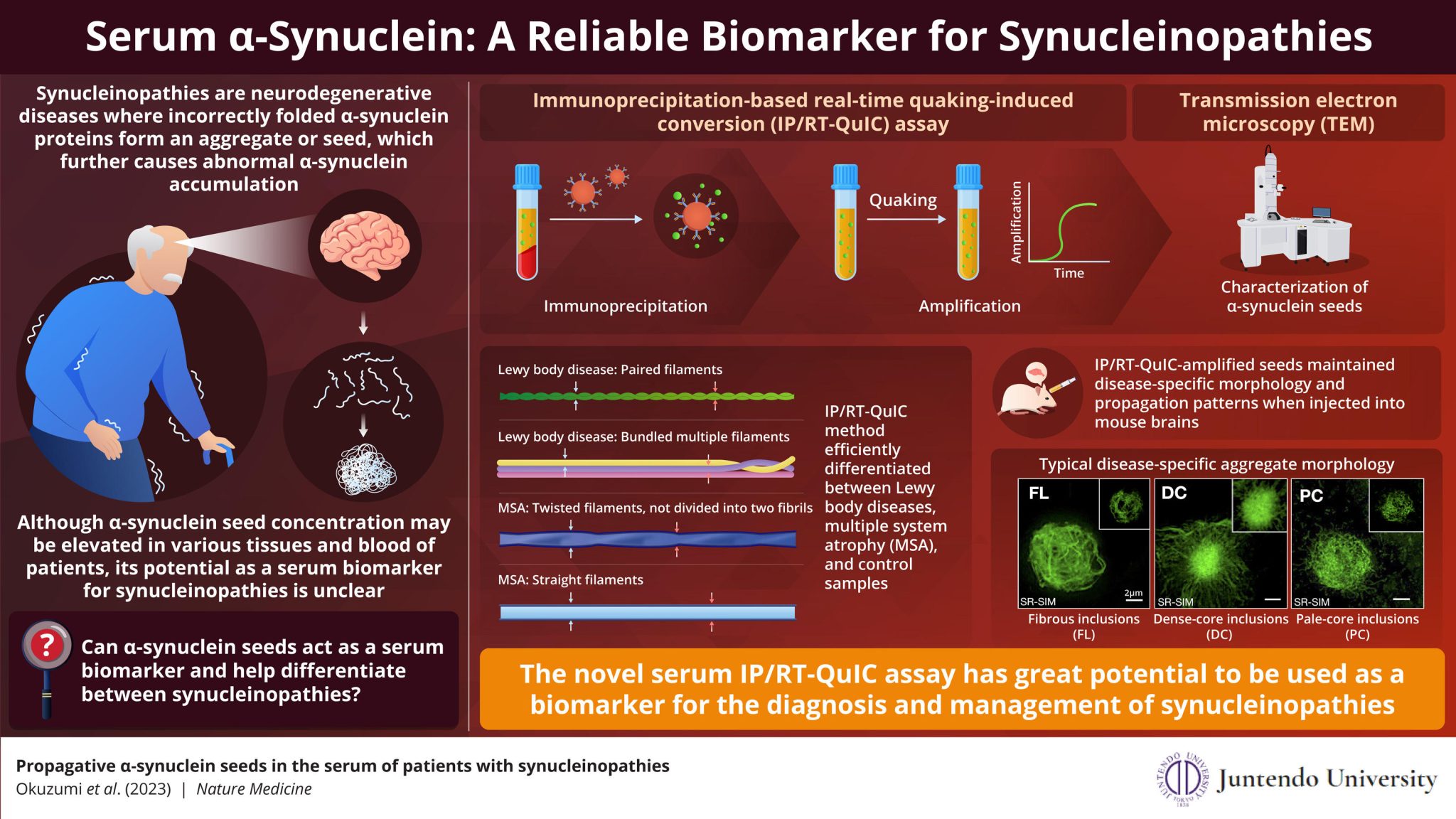 Spotting the Seeds of Neurodegeneration – Scientists Develop a ...