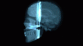 3D Brain Scan Side View