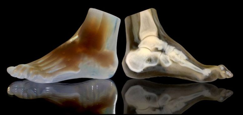 3D Printed Foot