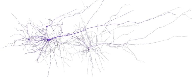 3D reconstruction of human cortical neurons