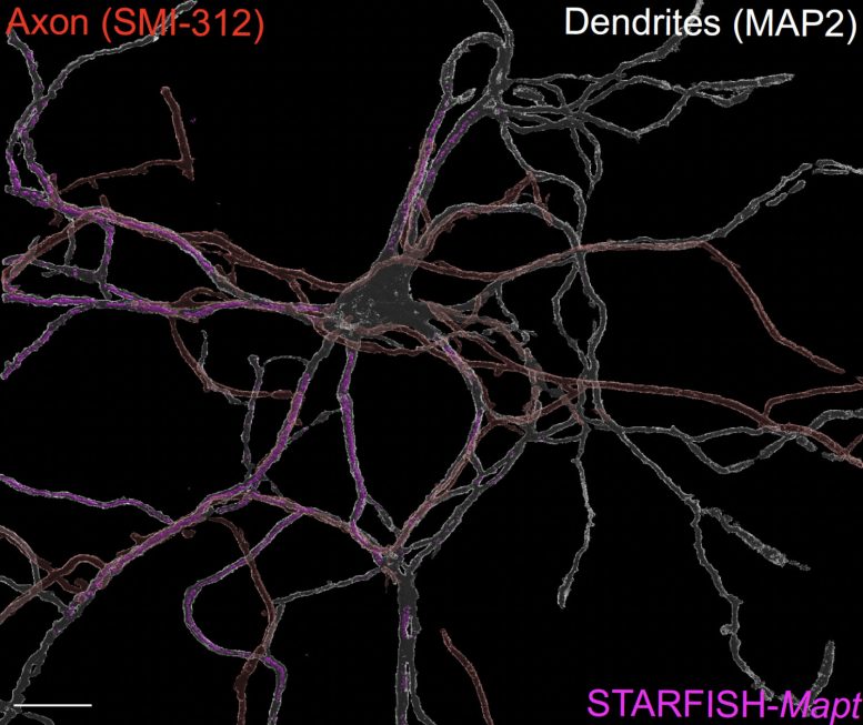 3D Reconstruction of Neuron Tau Proteins