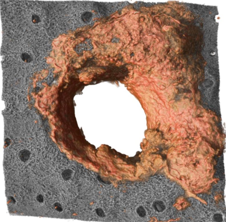 3D Reconstruction of a Collagen Ring Produced by Neutrophils
