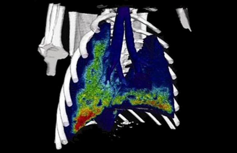 4D Dynamic Functional Lung Imaging