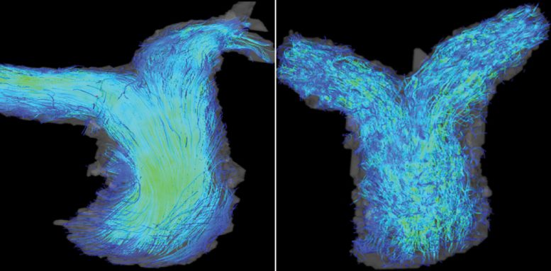 4D Flow Cardiac MRI