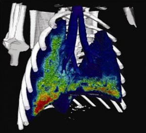 4D dynamic functional lung imaging method