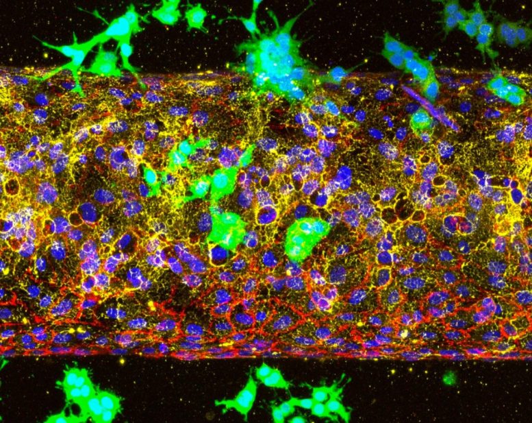A 3D Tumor Vessel on a Chip Model