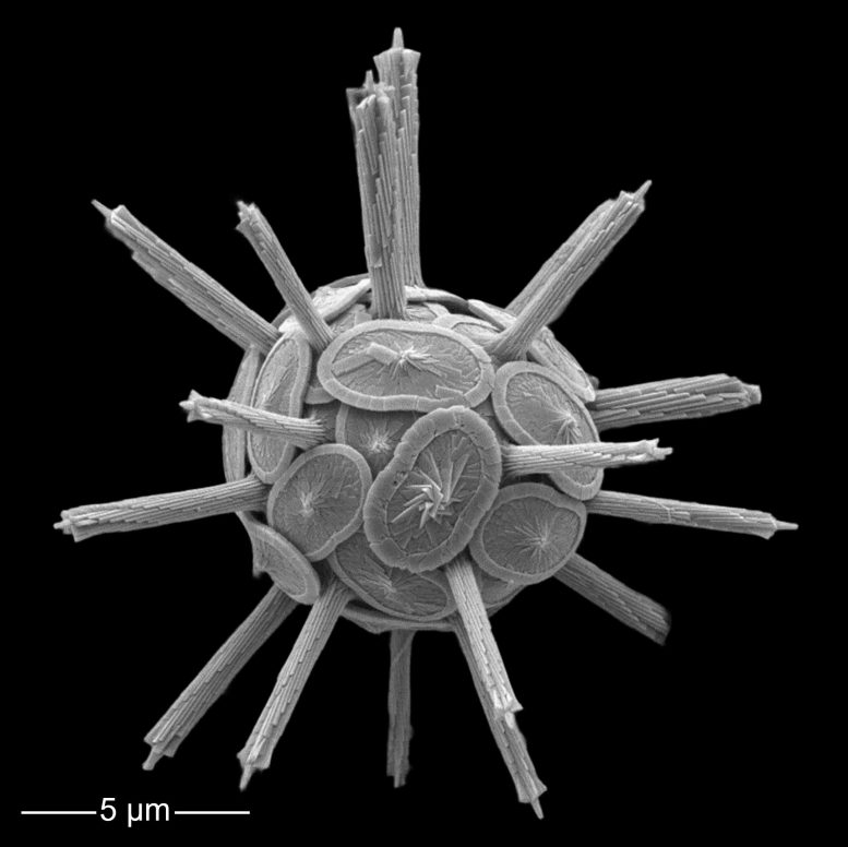 A Coccosphere of Rabdosphaera Clavigera